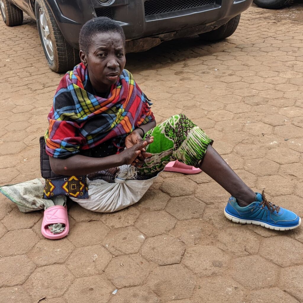 Anonciatha Mukangeneye, a middle-aged Ugandan woman, sits on the ground and looks into the camera. She has only one leg.